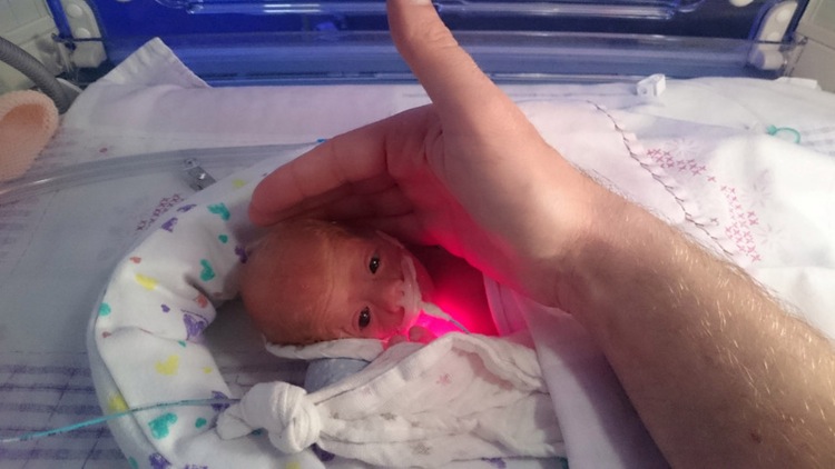 http---wp-prod-02.distractify.com-wp-content-uploads-2015-10-swns_miracle_baby_13