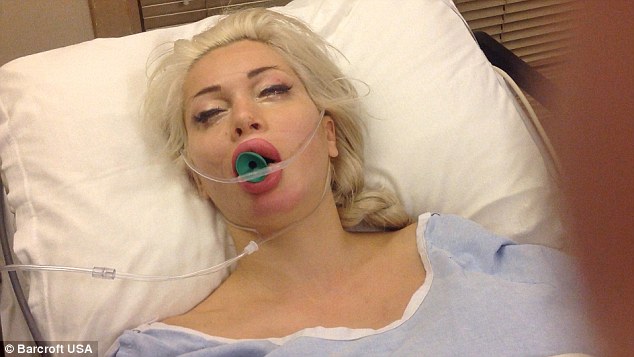 2ECDB36B00000578-3333707-She_underwent_the_extreme_five_hour_keyhole_surgery_in_Indianapo-a-117_1448470951903