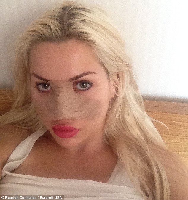 2ECDB71C00000578-3333707-The_blonde_has_always_been_self_conscious_about_her_nose_and_has-m-26_1448473203796