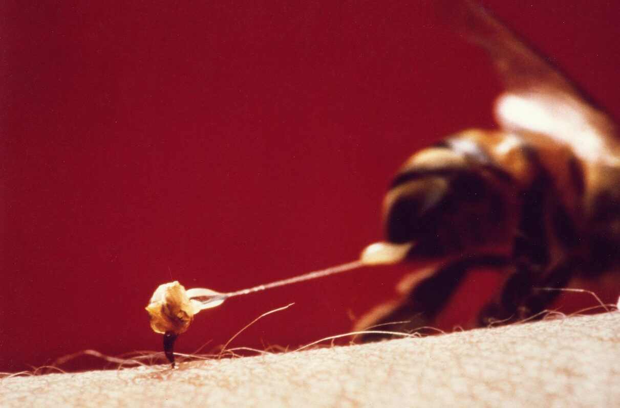bee-stinger
