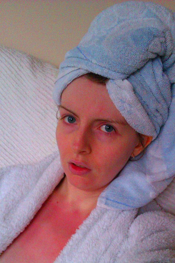 Rachel Prince having had an allergic reaction to water