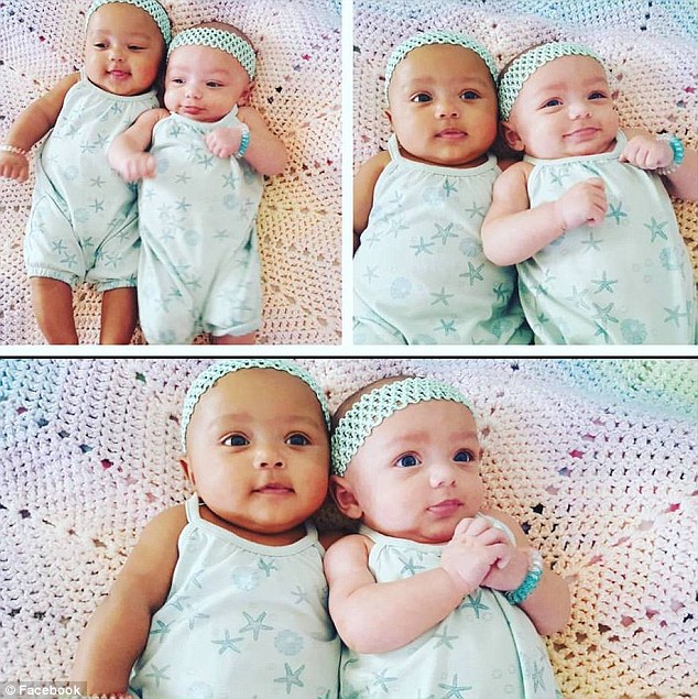 3C78581F00000578-0-The_adorable_girls_defied_1_in_500_odds_when_they_were_born_with-m-77_1485279880573