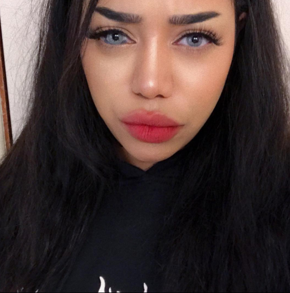 99