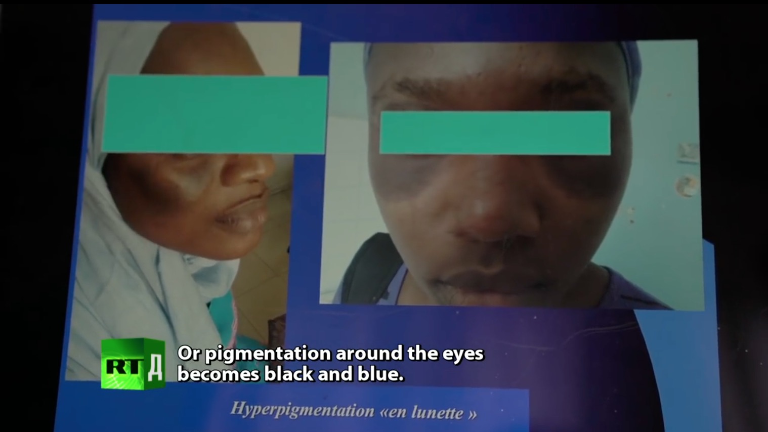 屏幕快照 2018-02-27 下午6.35.49