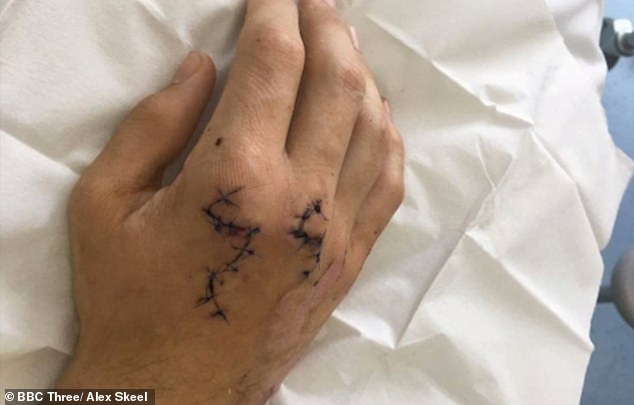9824166-6716559-Alex_required_stitches_in_his_hand_after_he_was_attacked_with_a_-a-16_1550497787138