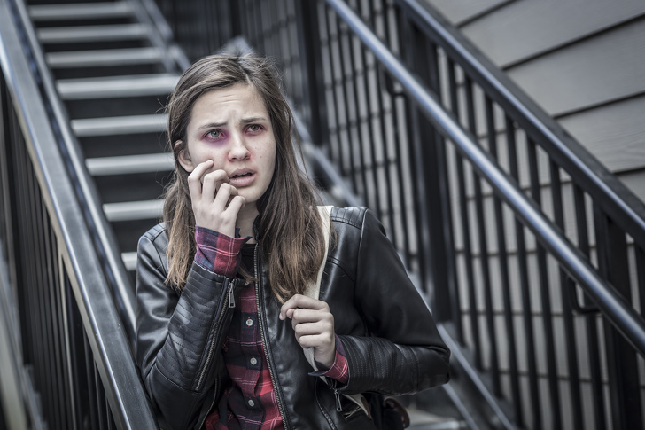 Young Badly Bruised and Frightened Girl with Backpack on Staircase.