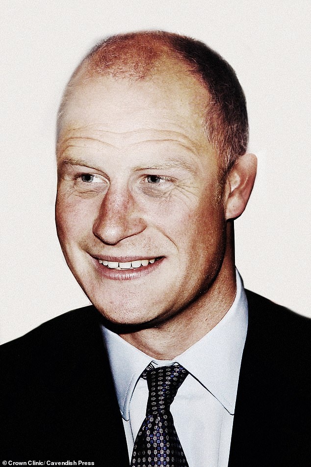 5873008-7983683-Is_this_what_Prince_Harry_will_look_like_at_50_Celebrity_surgeon-a-51_1581250098781.jpg