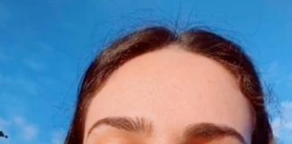 打个瘦脸针居然还会变这样?这个19岁妹子刚打完脸都变方了!