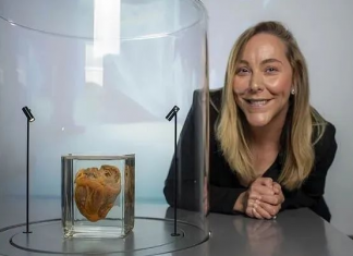 英国女子心脏移植后成功活命,16年后,她跟自己的旧心脏重逢了